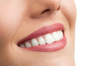 sorriso donna dentista