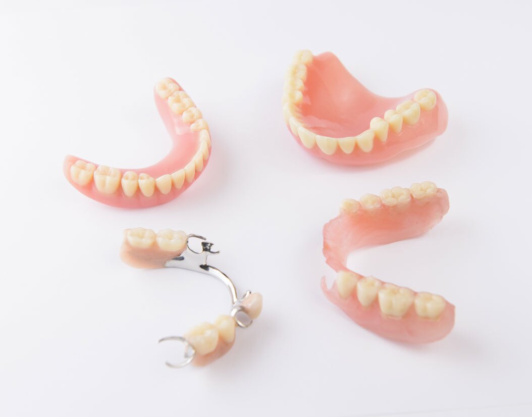 Protesi dentale fissa