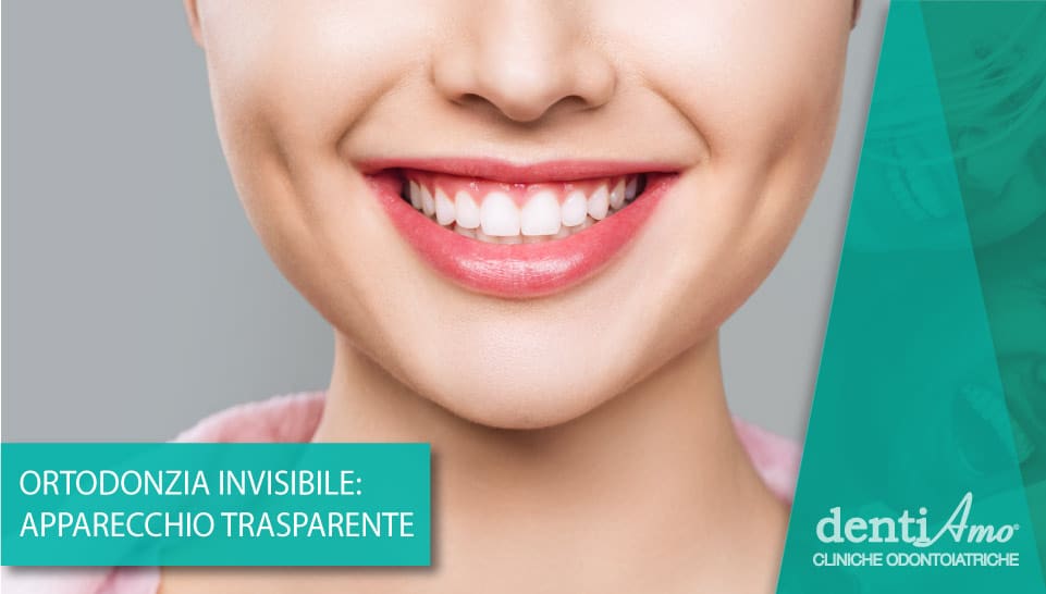 Ortodonzia invisibile: denti perfetti senza disagi estetici